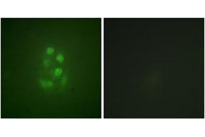Immunofluorescence analysis of A549 cells, using KIF2C (Phospho-Ser95) Antibody.