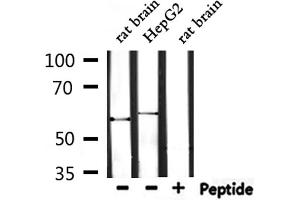 Image no. 2 for anti-Triple Functional Domain Protein (TRIO) (Internal Region) antibody (ABIN6257891)