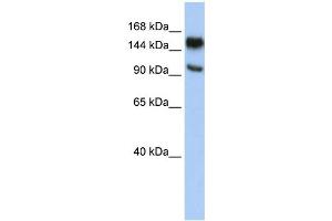 Image no. 1 for anti-Poly (ADP-Ribose) Polymerase Family, Member 10 (PARP10) (Middle Region) antibody (ABIN2773811)