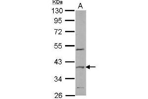 Image no. 2 for anti-Speckle-Type POZ Protein (SPOP-B) (Center) antibody (ABIN2856462)