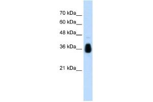 Image no. 1 for anti-Makorin Ring Finger Protein 1 (MKRN1) (C-Term) antibody (ABIN2774708)