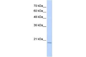Image no. 1 for anti-RNA Binding Motif Protein 39 (RBM39) (Middle Region) antibody (ABIN2778917)