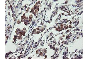 Image no. 7 for anti-Tumor Protein D52-Like 3 (TPD52L3) antibody (ABIN1501475)