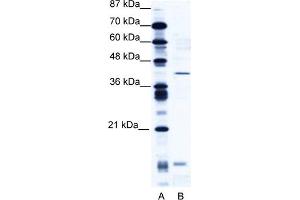 Image no. 1 for anti-CAMP Responsive Element Modulator (CREM) (N-Term) antibody (ABIN2776016)