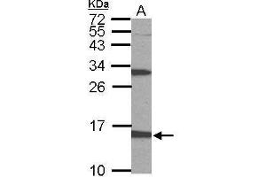 Image no. 2 for anti-6-Pyruvoyltetrahydropterin Synthase (PTS) (full length) antibody (ABIN2856764)
