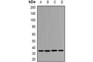 Image no. 2 for anti-Dehydrogenase/reductase (SDR Family) Member 9 (DHRS9) antibody (ABIN3198034)