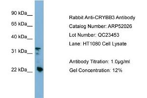 Image no. 2 for anti-Crystallin, beta B3 (CRYbB3) (Middle Region) antibody (ABIN2784738)