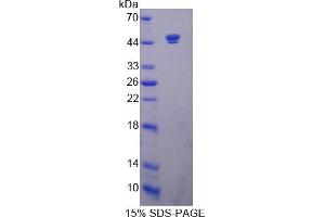 Image no. 1 for Sirtuin 7 (SIRT7) (AA 1-400) protein (His tag) (ABIN6237077)