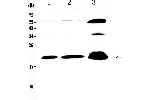 Image no. 2 for anti-Protein Phosphatase 1, Regulatory (Inhibitor) Subunit 14A (PPP1R14A) (AA 30-126) antibody (ABIN5518865)