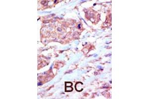 Image no. 1 for anti-EPH Receptor B6 (EPHB6) (AA 990-1021), (C-Term) antibody (ABIN391928)