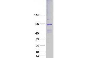 Image no. 1 for Bestrophin 1 (BEST1) (Transcript Variant 1) protein (Myc-DYKDDDDK Tag) (ABIN2715224)