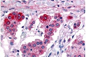 G Protein-Coupled Receptor 182 antibody  (C-Term)