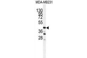 Image no. 2 for anti-Cathepsin S (CTSS) antibody (ABIN3003177)