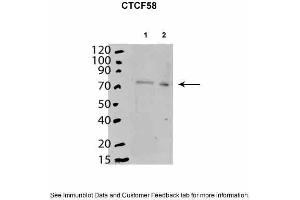 Image no. 3 for anti-CCCTC-Binding Factor (Zinc Finger Protein) (CTCF) (C-Term) antibody (ABIN2777204)