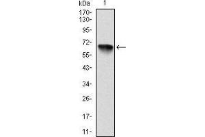Image no. 1 for anti-Ribosomal Protein S6 Kinase, 90kDa, Polypeptide 3 (RPS6KA3) antibody (ABIN969386)
