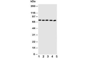 Image no. 1 for anti-ATP-Binding Cassette, Sub-Family G (WHITE), Member 5 (ABCG5) (N-Term) antibody (ABIN3030065)