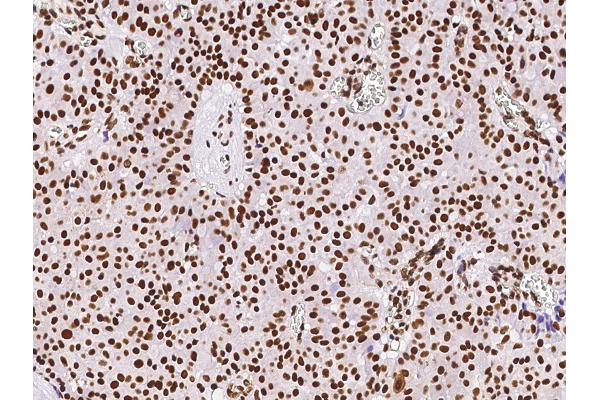 anti-Retinoblastoma Binding Protein 4 (RBBP4) (C-Term) antibody