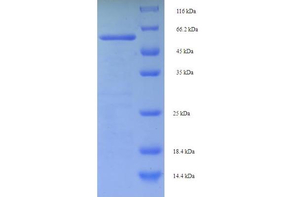 MSH6 Protein (AA 1-400, partial) (His-SUMO Tag)