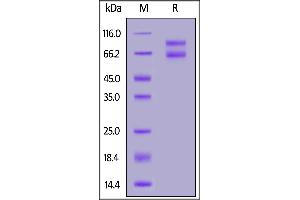 SDS-PAGE (SDS) image for IL-2 R beta & IL-2 R gamma (AA 27-239) (Active) protein (Fc Tag,AVI tag,Biotin) (ABIN6973116)