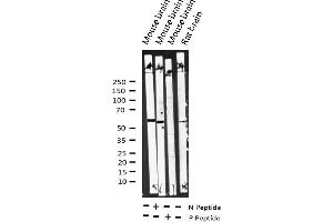 Image no. 2 for anti-Disabled Homolog 1 (Drosophila) (DAB1) (pTyr232) antibody (ABIN6256680)