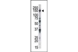 Image no. 2 for anti-NIMA-Related Kinase 1 (NEK1) (AA 1173-1202), (C-Term) antibody (ABIN360536)