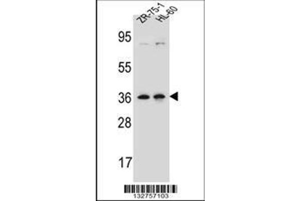 anti-Leucine Zipper Protein 2 (LUZP2) (AA 96-124), (N-Term) antibody
