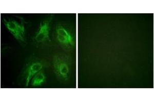 Immunofluorescence analysis of HeLa cells, using Calsenilin/KCNIP3 (Phospho-Ser63) Antibody.