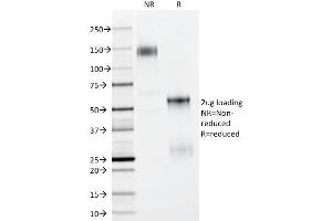 Image no. 4 for anti-Tumor Protein P63 (TP63) (AA 5-17) antibody (ABIN6940969)