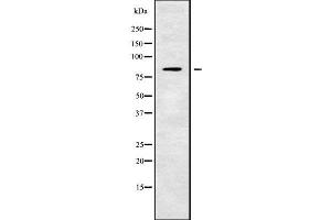 Image no. 1 for anti-Transmembrane Channel-Like 7 (TMC7) (C-Term) antibody (ABIN6265609)