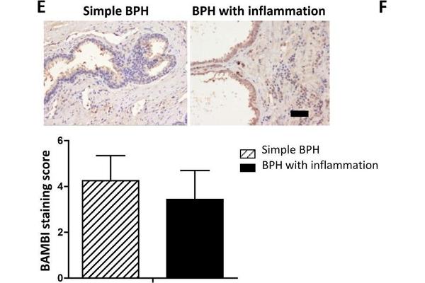 anti-BMP and Activin Membrane-Bound Inhibitor Homolog (BAMBI) (AA 101-200) antibody