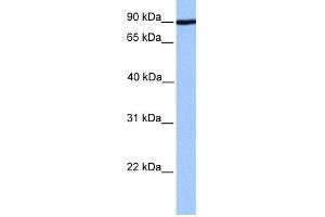 Image no. 1 for anti-ADAM Metallopeptidase Domain 2 (ADAM2) (Middle Region) antibody (ABIN2785463)