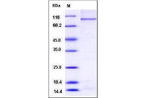 Image no. 1 for Poly (ADP-Ribose) Polymerase Family, Member 3 (PARP3) (AA 1-533), (C-Term) protein (GST tag,His tag) (ABIN2004066)