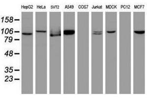 Image no. 5 for anti-Cullin 4B (CUL4B) (AA 1-300) antibody (ABIN1490724)