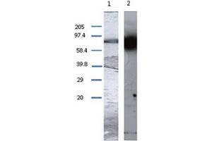 Image no. 1 for anti-Transglutaminase 1, Keratinocyte (TGM1) antibody (ABIN1109300)