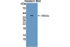 Image no. 4 for anti-Hydroxysteroid (17-Beta) Dehydrogenase 12 (HSD17B12) (AA 1-312) antibody (ABIN5013035)