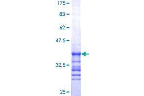 Synovial Sarcoma Translocation Gene On Chromosome 18-Like 1 (SS18L1) (AA 112-200) protein (GST tag)