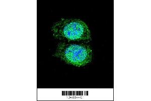 Image no. 3 for anti-B-Cell CLL/lymphoma 2 (BCL2) (AA 75-110) antibody (ABIN388095)