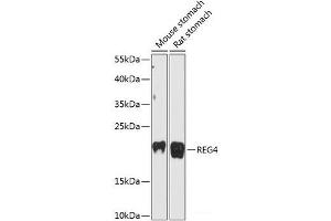 Western blot analysis of extracts of various cell lines using REG4 Polyclonal Antibody at dilution of 1:3000.