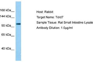 Image no. 1 for anti-Tudor Domain Containing 7 (TDRD7) (C-Term) antibody (ABIN2785999)