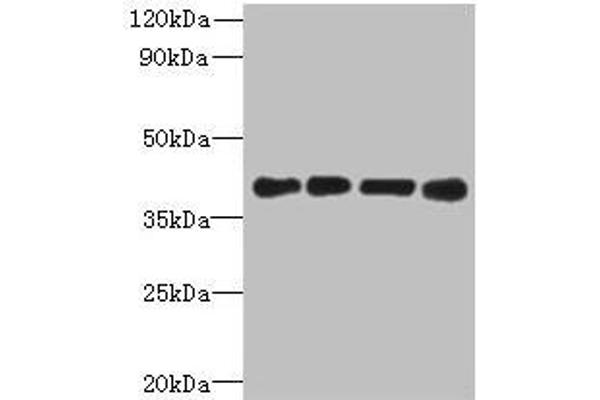 MAGEB18 抗体  (AA 1-270)