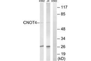 Image no. 1 for anti-CCR4-NOT Transcription Complex Subunit 4 (CNOT4) (AA 61-110) antibody (ABIN1534740)