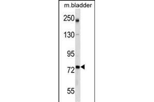 GCLC Antibody (Center) (ABIN1538246 and ABIN2849959) western blot analysis in mouse bladder tissue lysates (35 μg/lane).