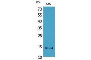 Image no. 1 for anti-CD59 (CD59) (Internal Region) antibody (ABIN3187782)