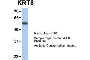Image no. 2 for anti-Keratin 8 (KRT8) (Middle Region) antibody (ABIN2777113)