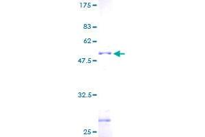 Zinc Finger Protein 22 Protein (ZNF22) (AA 1-224) (GST tag)
