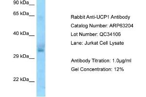 Image no. 1 for anti-Uncoupling Protein 1 (Mitochondrial, Proton Carrier) (UCP1) (N-Term) antibody (ABIN2789412)