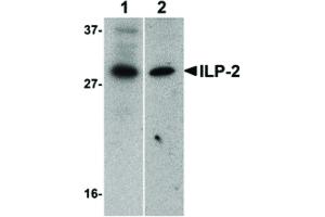 Image no. 1 for anti-Baculoviral IAP Repeat-Containing 8 (BIRC8) (N-Term) antibody (ABIN6656732)
