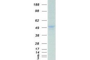 Image no. 1 for Pre-B-Cell Leukemia Homeobox Protein 1 (PBX1) protein (Myc-DYKDDDDK Tag) (ABIN2729562)