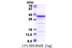 Image no. 1 for TAF15 RNA Polymerase II, TATA Box Binding Protein (TBP)-Associated Factor, 68kDa (TAF15) (AA 148-406) protein (His tag) (ABIN5853424)