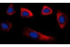 Image no. 1 for anti-Glycerate Kinase (GLYCTK) (Center) antibody (ABIN3071141)